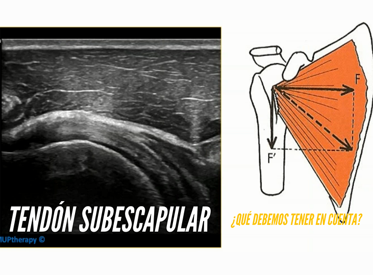 tendon-subescapular-ecografia-con-adrian-benito